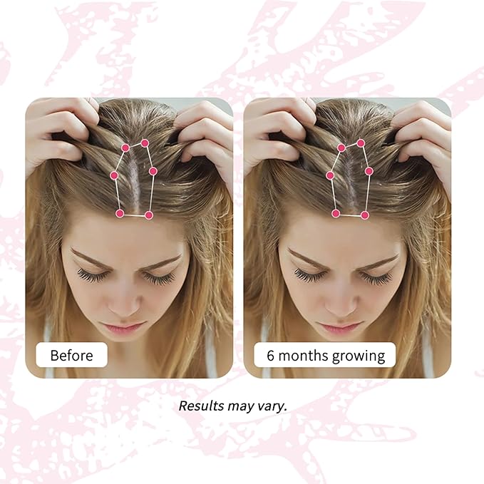 Women's Hair Growth Supplement Gummies, Nourishes Thinning Hair & Boosts Hair Thickness, with Collagen, Biotin, Zinc, Vitamin C & Iron – Pineapple Flavor – 90 Gummies, 45 Day Supply