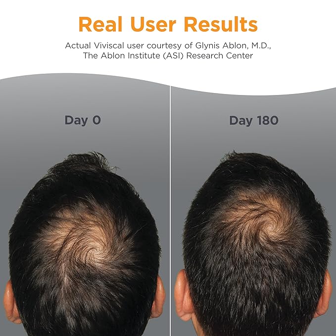 Viviscal Men's Hair Growth Supplements for Thicker Fuller Hair, Clinically Proven Collagen Complex, 60 Tablets 1 Month Supply