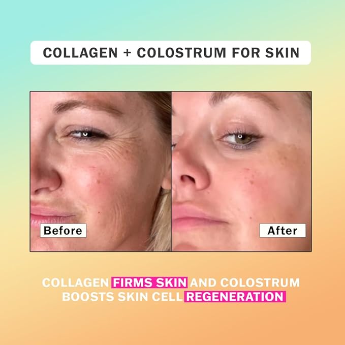 Colostrum & Collagen Peptides Powder | Biotin, Hyaluronic Acid & Vitamin C | Gut, Immune System, Hair, Skin & Nails Supplement | for Women & Men | 12oz, Unflavored, 30 Servings