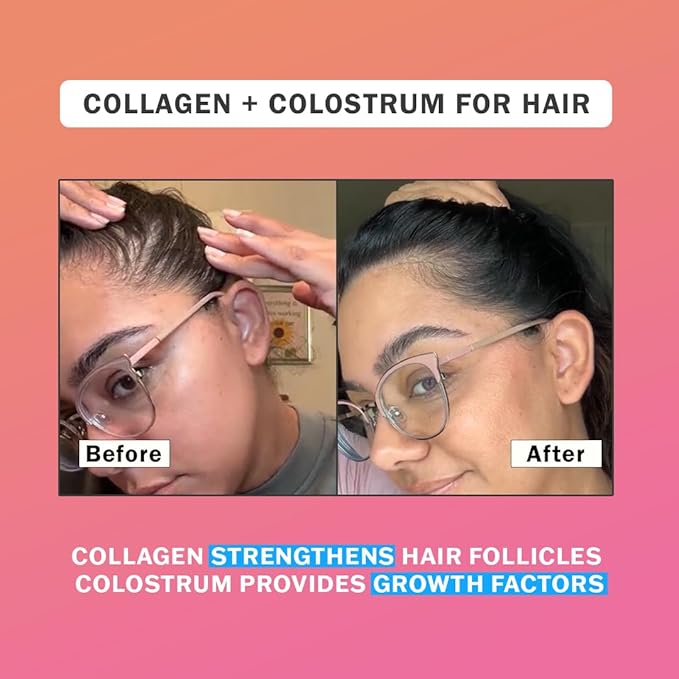 Colostrum & Collagen Peptides Powder | Biotin, Hyaluronic Acid & Vitamin C | Gut, Immune System, Hair, Skin & Nails Supplement | for Women & Men | 12oz, Unflavored, 30 Servings