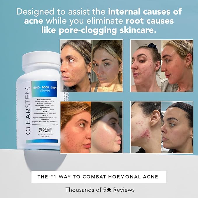 CLEARSTEM - MINDBODYSKIN Hormonal Acne Supplement (5-HTP) - Natural DIM Supplement - Skin Care Vitamins - Hormone Balance, Antioxidants - Gluten Free, Cruelty Free - 60 Servings, 180 Capsules