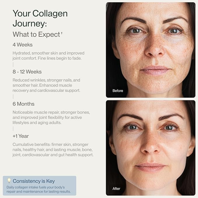 Collagen Peptides Powder Grass-Fed Pasture-Raised Hydrolyzed Collagen Powder, Type I & III Hair, Nails, Skin and Joints, Non-GMO, Paleo & Keto, Unflavored, 10 Fl oz. 30 Servings