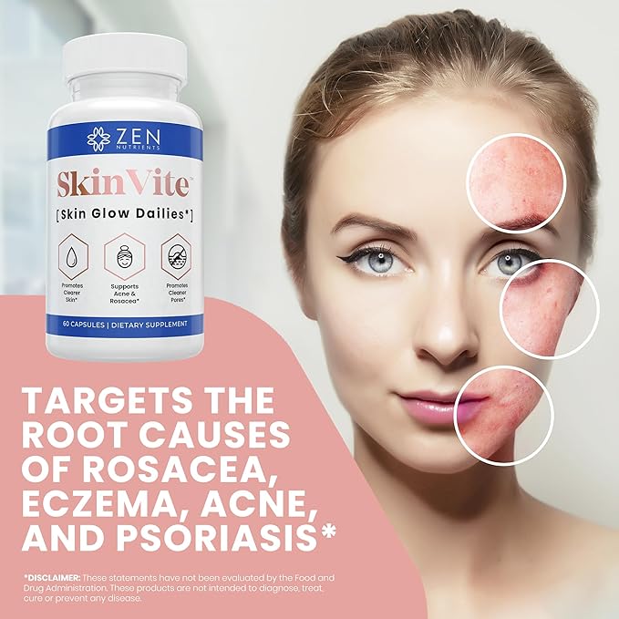 Zen Nutrients SkinVite Natural Skin Supplement for Women, Men & Teens - Hormonal Breakouts & Clear Skin Support Supplement - Detoxifying Vitamin for Acne and Digestion Support