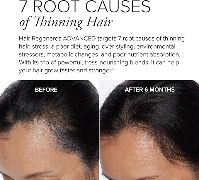 Hair Regeneres Advanced - Reduces Hair Shedding & Breakage - Promote Scalp Health - Stress-Related Hair Loss – Ashwagandha and Marine Collagen, 90 Ct